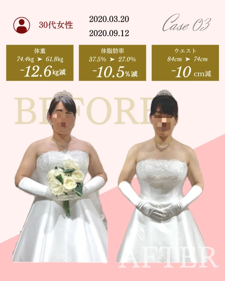 Before&After 3